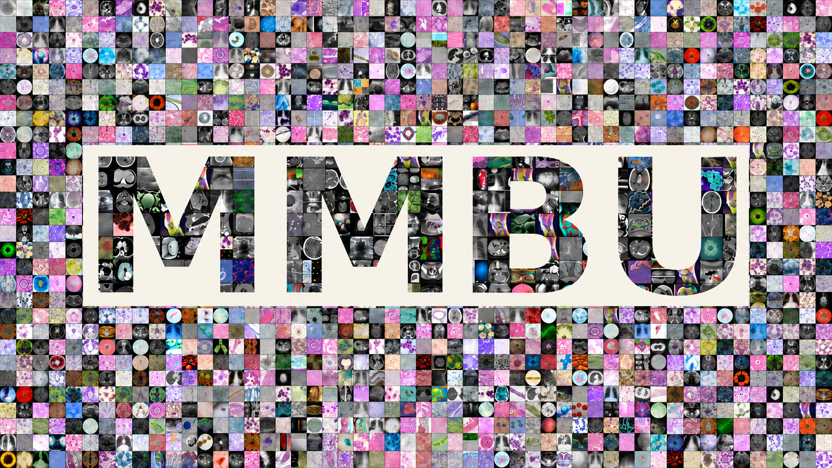 MMBU Challenge